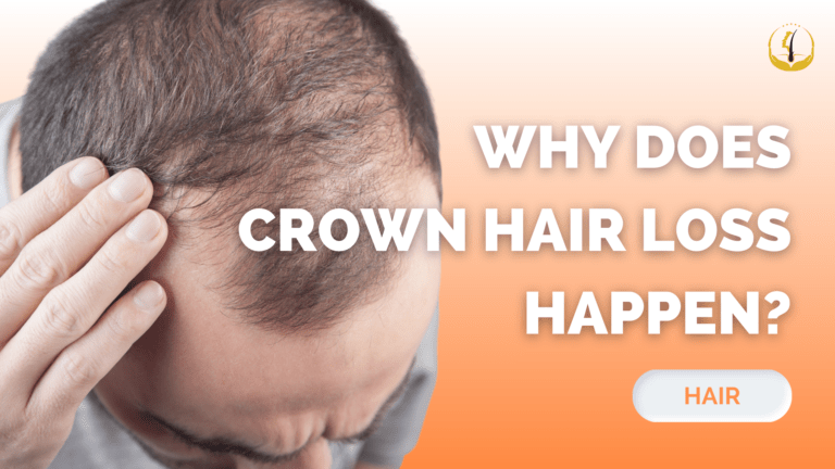 crown-hair-loss