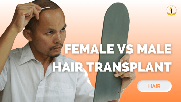 hair transplant