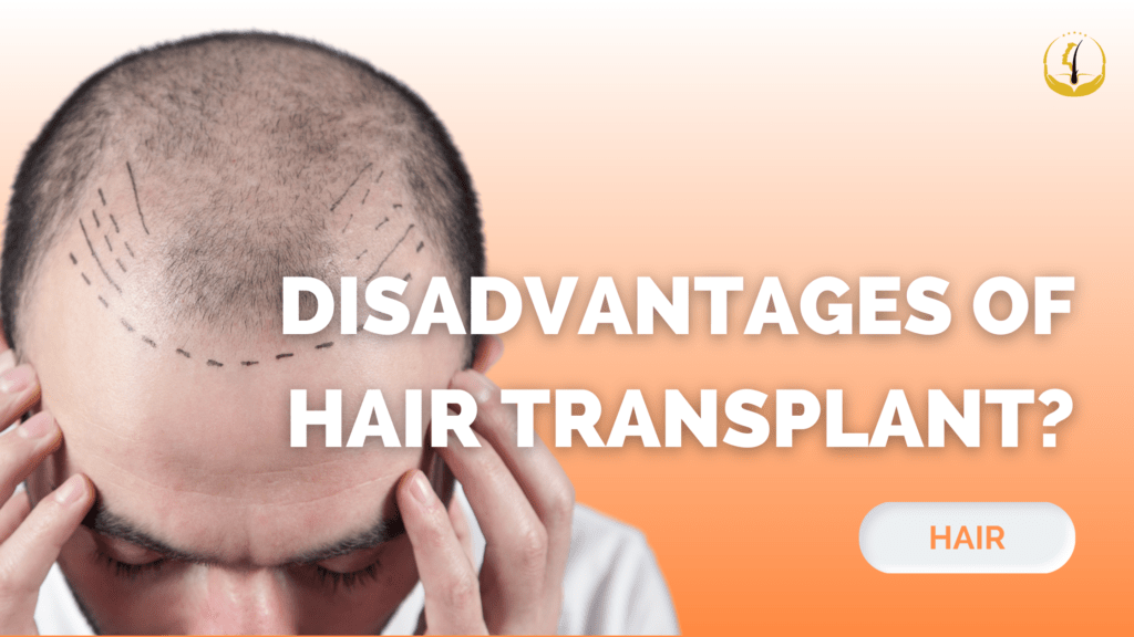 disadvantages-of-hair-transplant