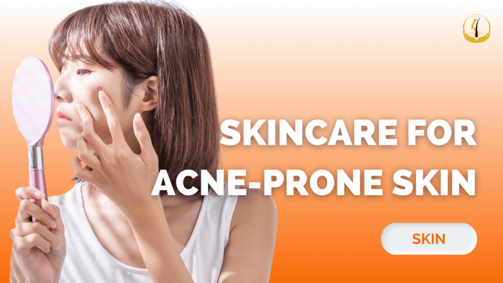 acne-prone-skin