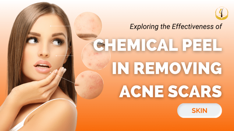 removing-acne-scars