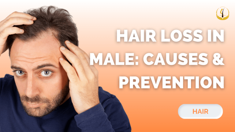 hair-loss-in-male