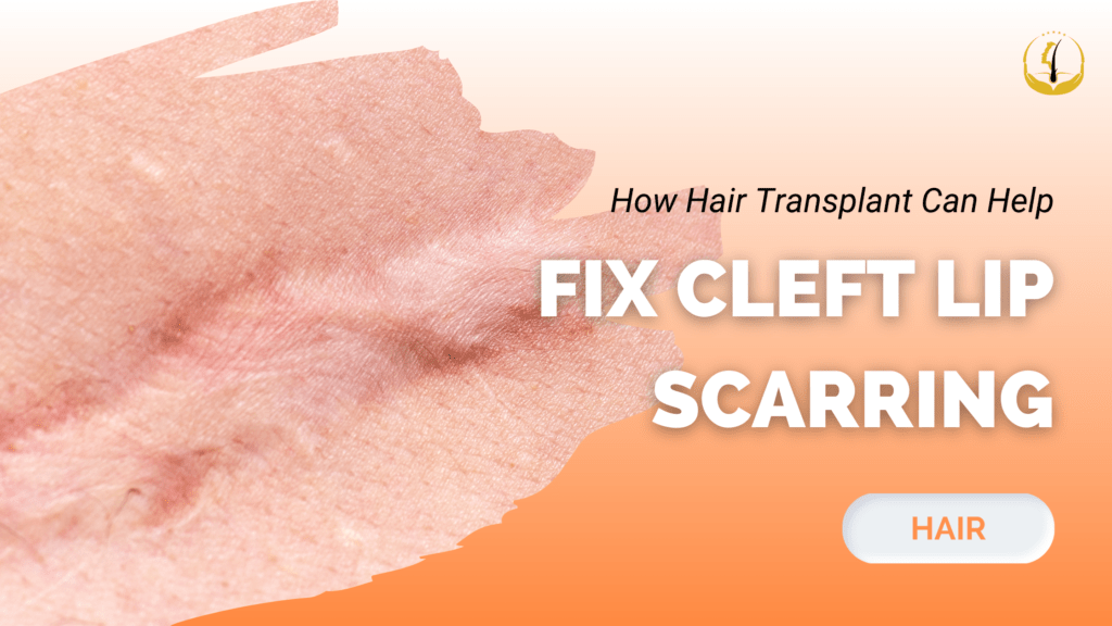 hair transplant