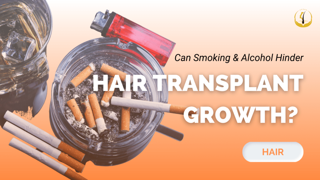 smoking-alcohol hinder-hair-transplant-growth