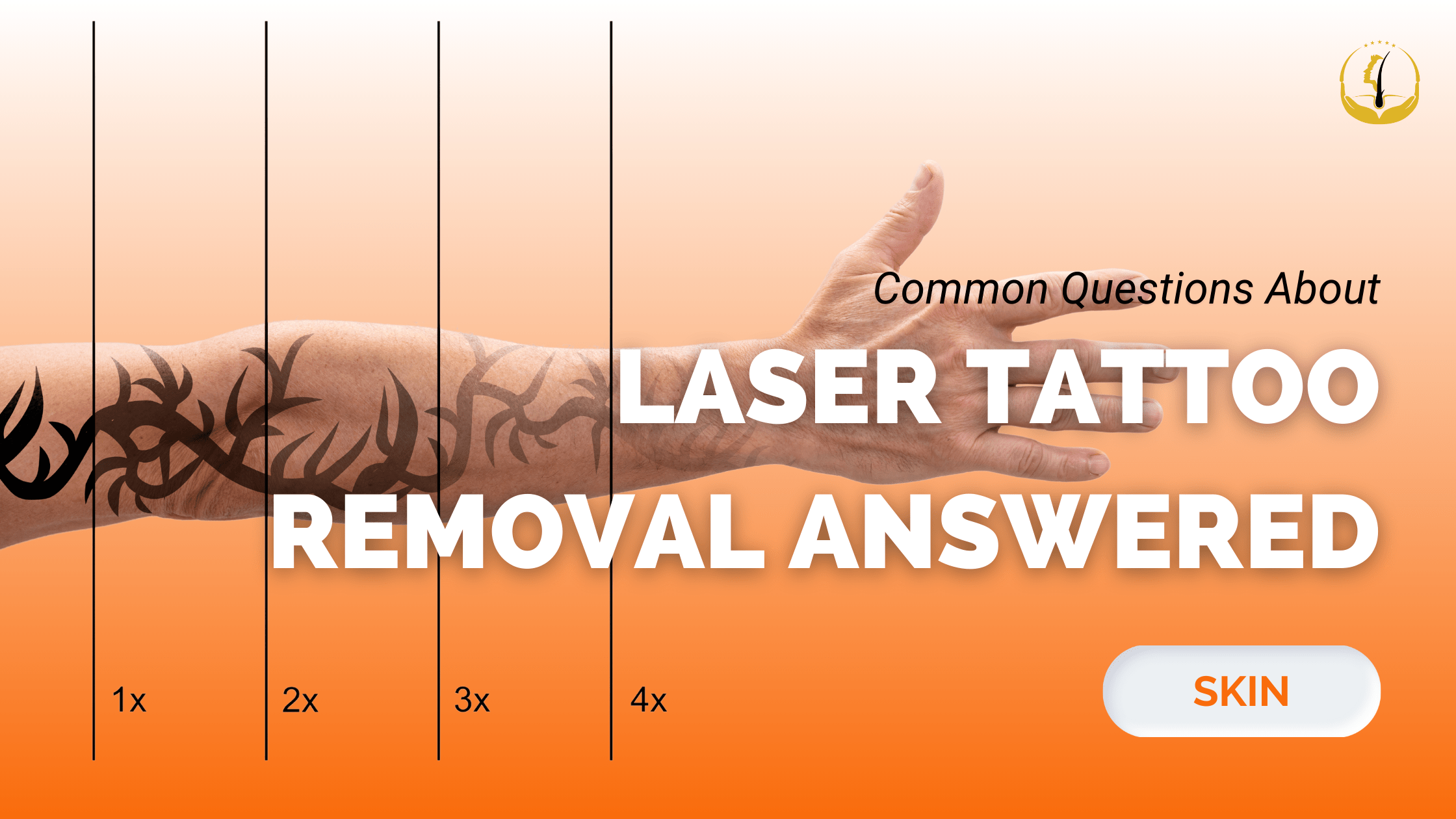 laser-tattoo-removal