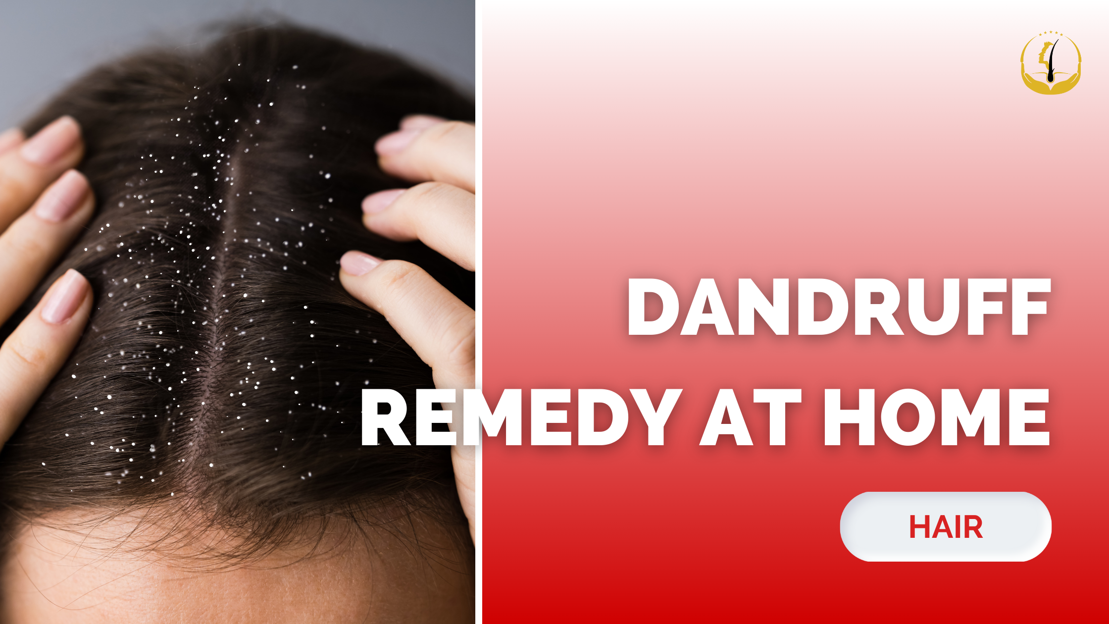 Dandruff Remedy at Home