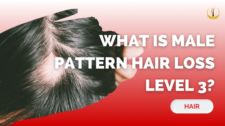 male pattern hair loss