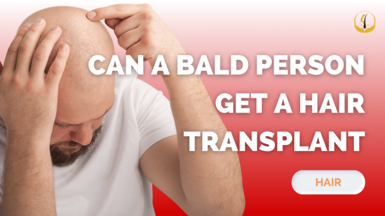 hair transplant