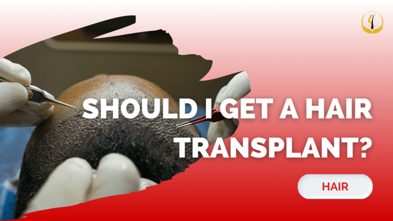 hair transplant