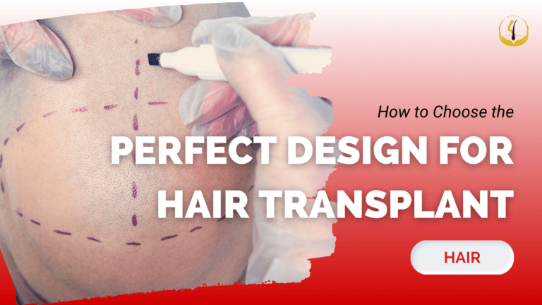 hair transplant