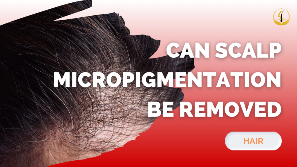 hair transplant