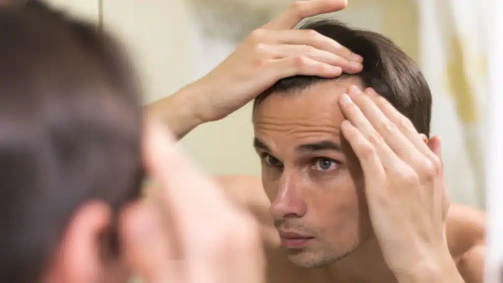 hair loss treatment malaysia