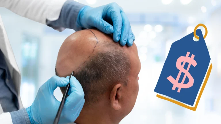 hair transplant price in malaysia