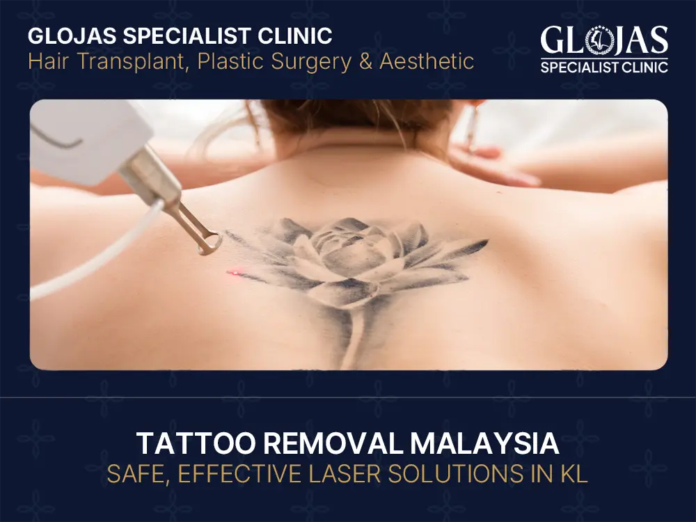 laser-tattoo-removal-kl-malaysia-cheap-affordable-near-me