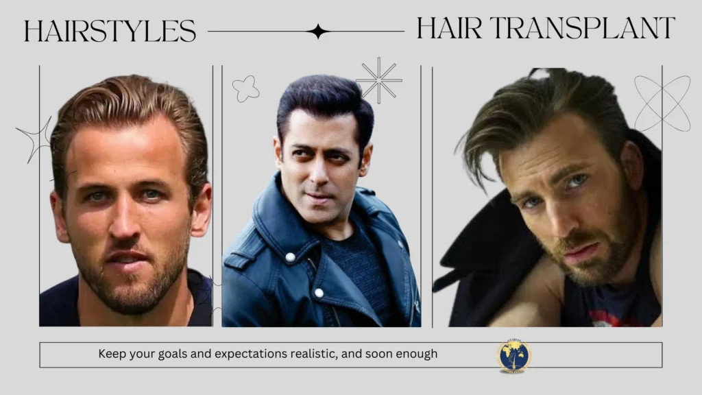 hair transplant hairstyles