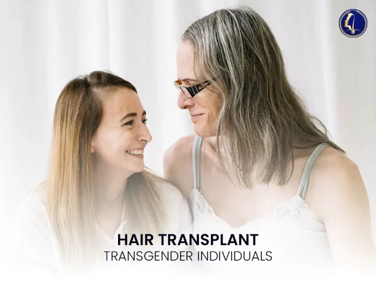 hair-transplant-transgender