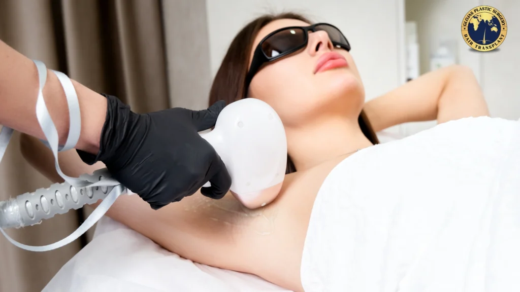 laser hair removal