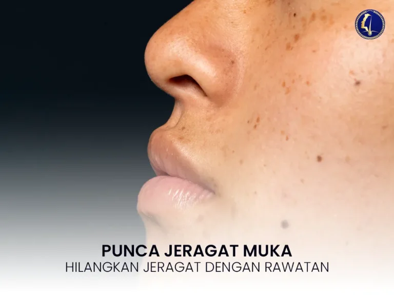 punca-jeragat-muka-pipi-rawatan-klinik-wajah-1