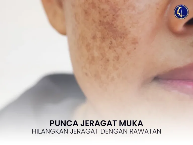 punca-jeragat-muka-pipi-rawatan-klinik-wajah