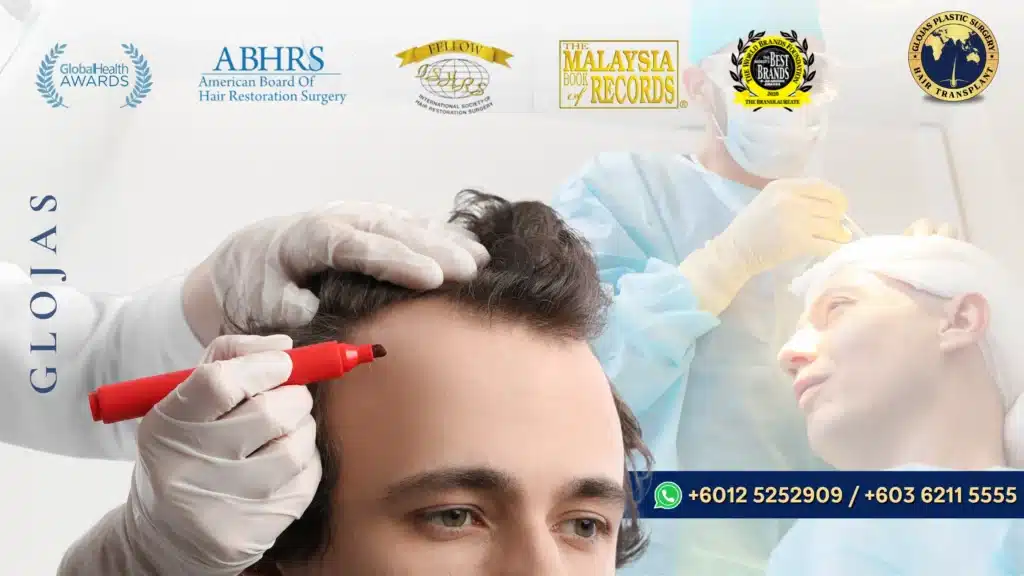 repair hair transplant malaysia