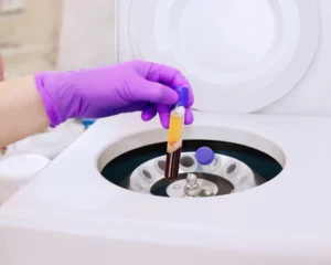 Centrifugation