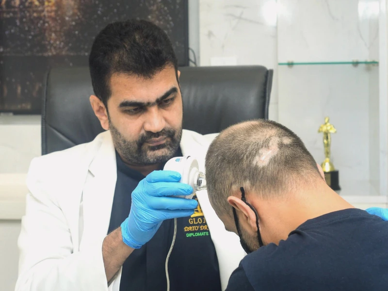 consultation-planning-fue-hair-transplant-in-malaysia-specialist