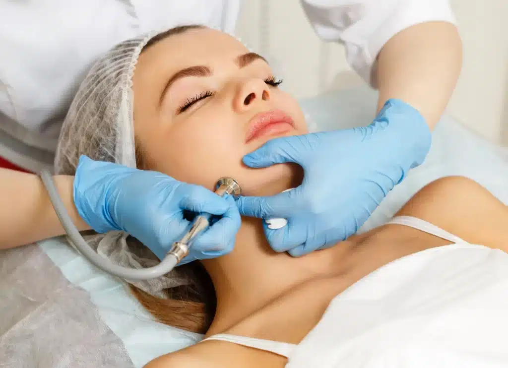 Microdermabrasion