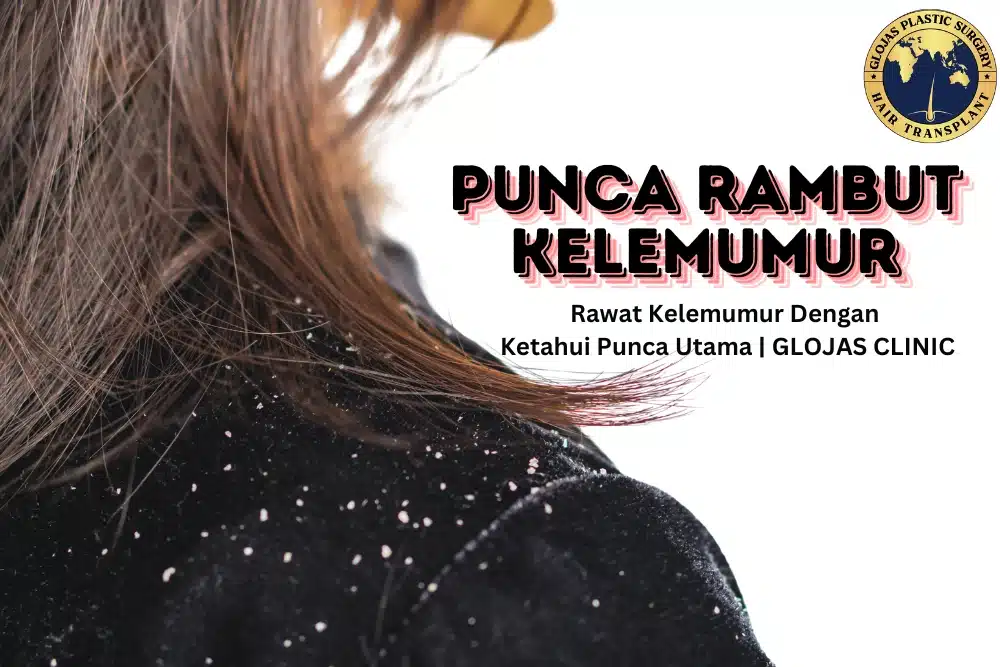 Punca Rambut Kelemumur