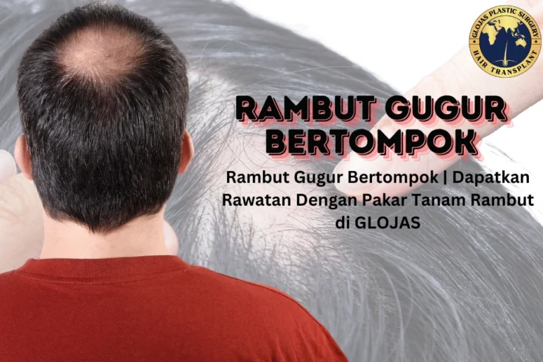 Rambut gugur bertompok