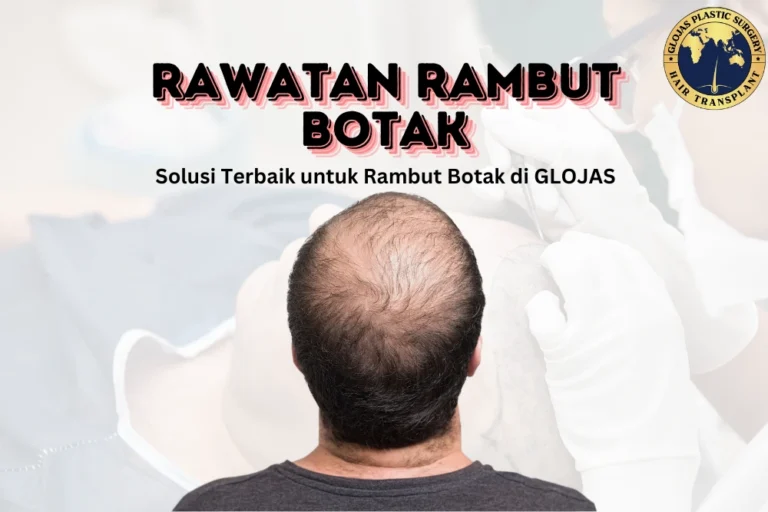 Rawatan Rambut Botak