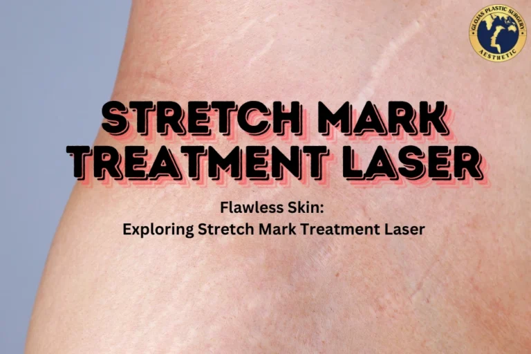 Stretch Mark Treatment Laser