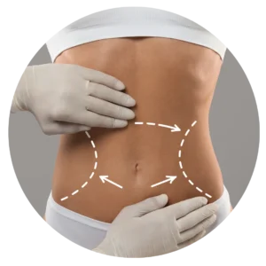 Tummy liposuction