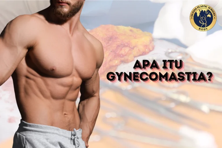 apa itu gynecomastia