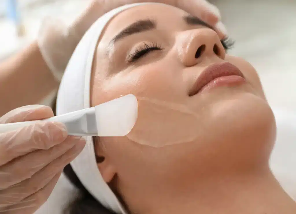 chemical skin peel