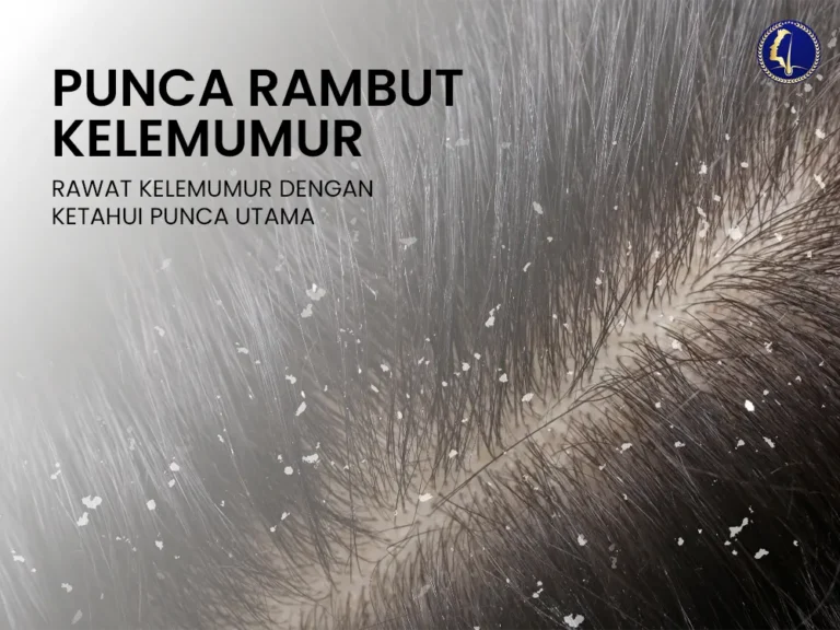 rambut-kelemumur-punca-utama-atasi-masalah-hair-dandruff