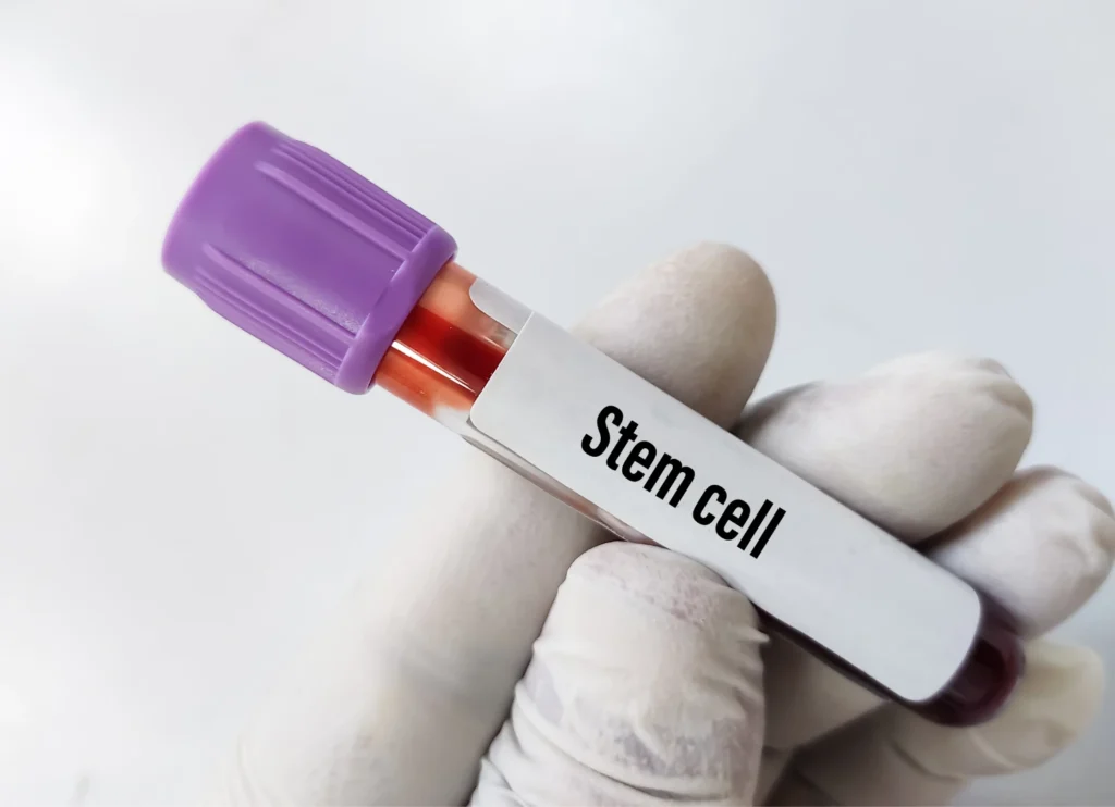 stem cell hair loss