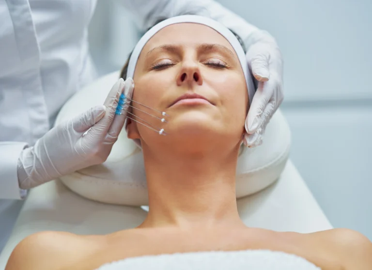 thread-lift-treatment-kuala-lumpur-malaysia