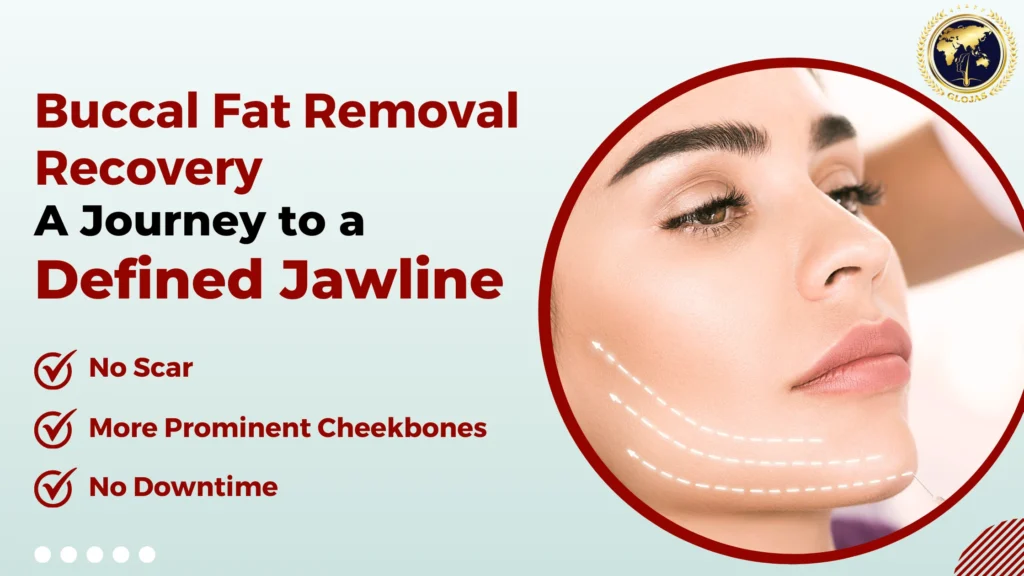 Buccal Fat Removal Recovery