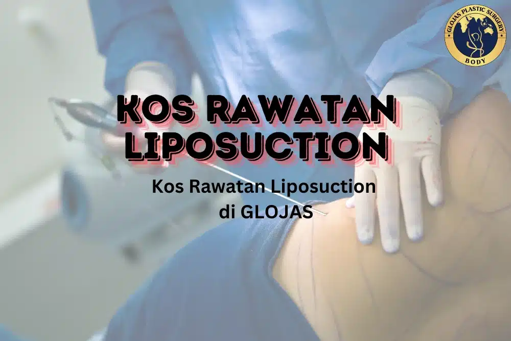 Kos Rawatan Liposuction