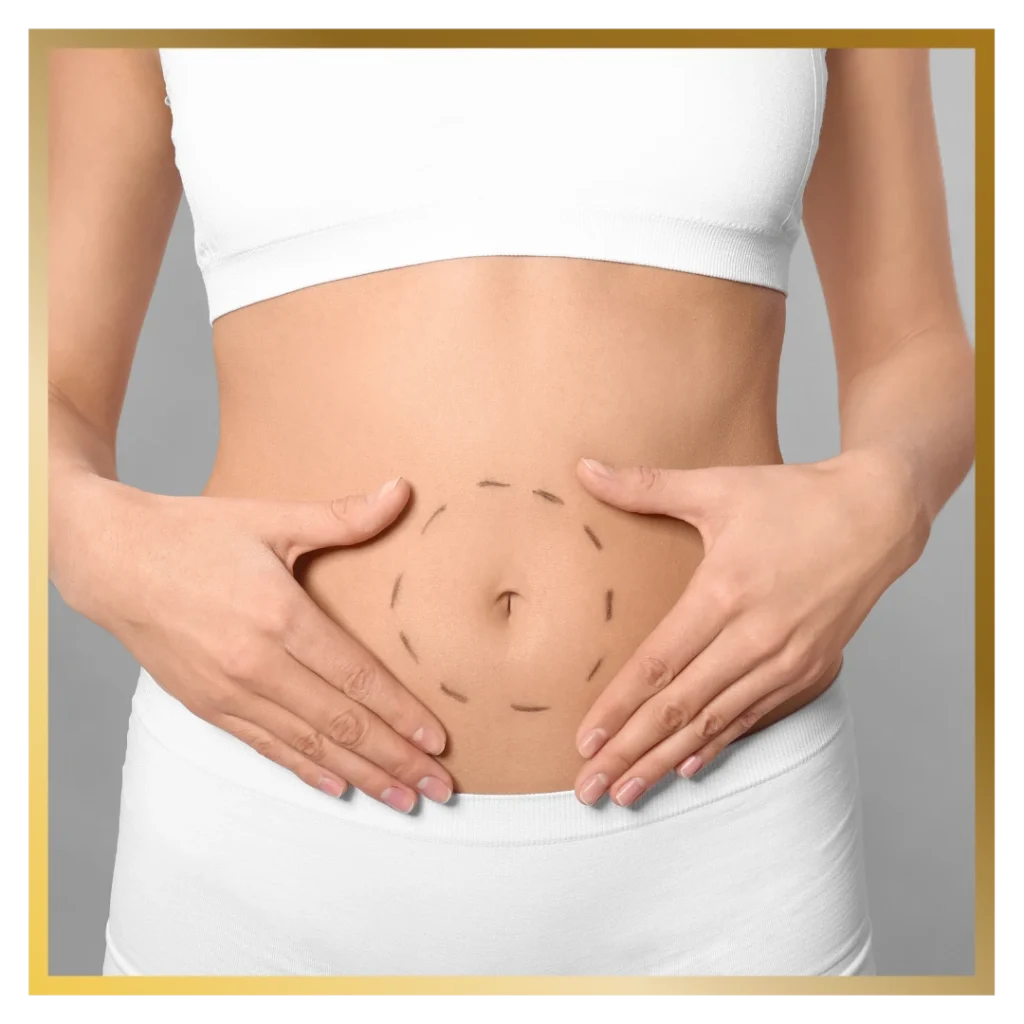 Mini Tummy Tuck glojas