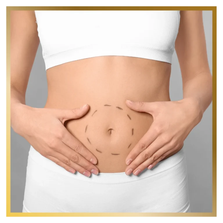 plastic-surgery-malaysia-reconstructive-surgeon-mini-tummy-truck