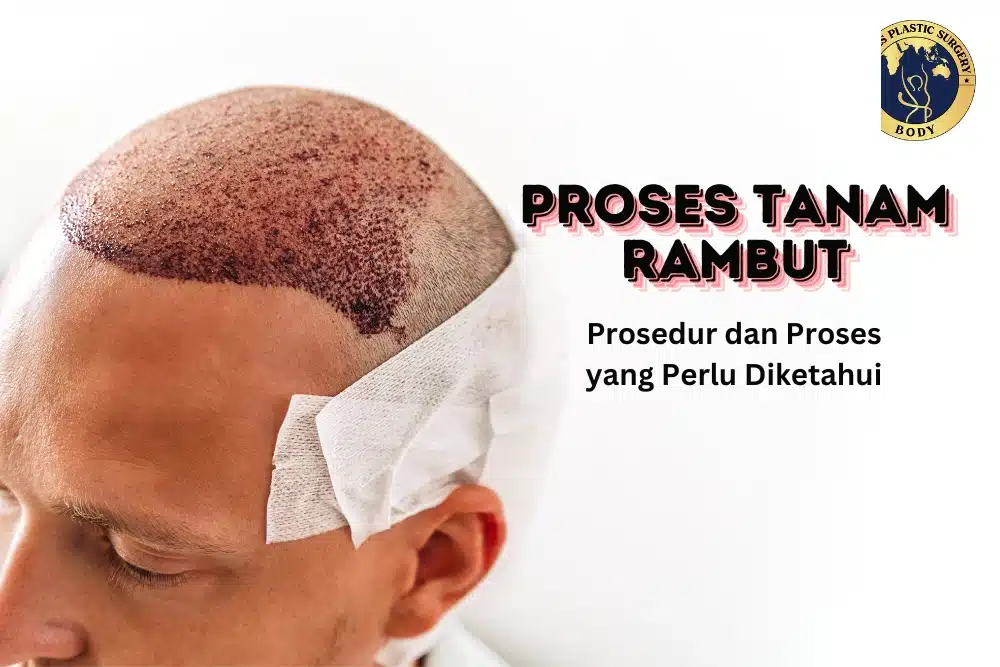 Proses Tanam Rambut