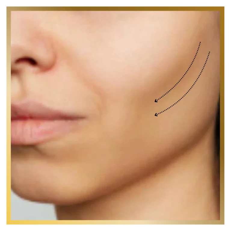 plastic-surgery-malaysia-reconstructive-surgeon-buccal-fat-removal
