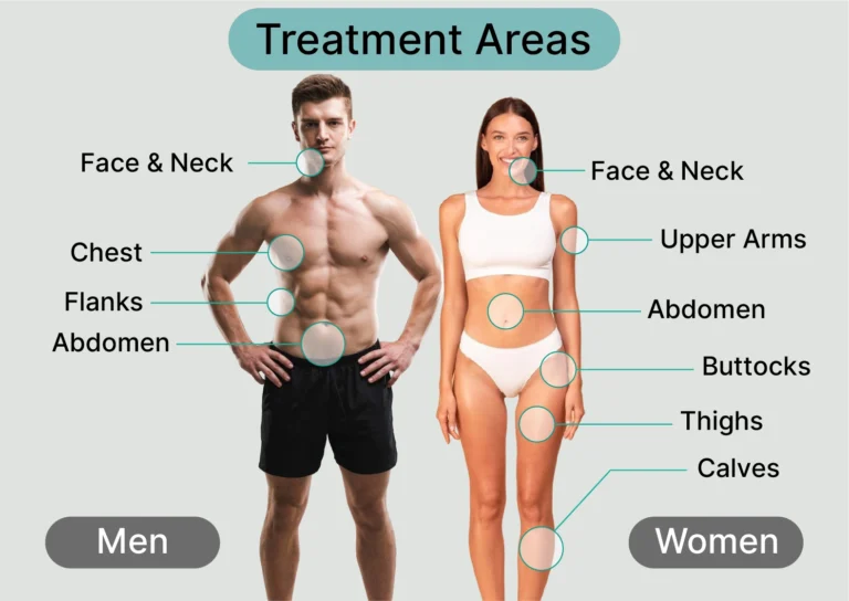 liposuction-area