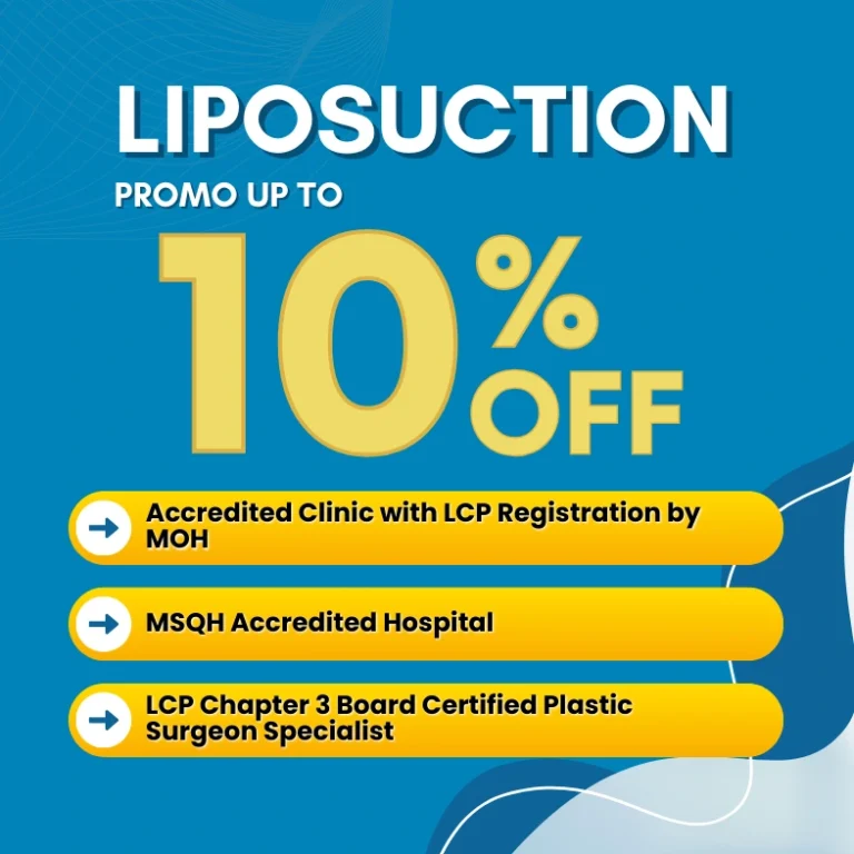 liposuction