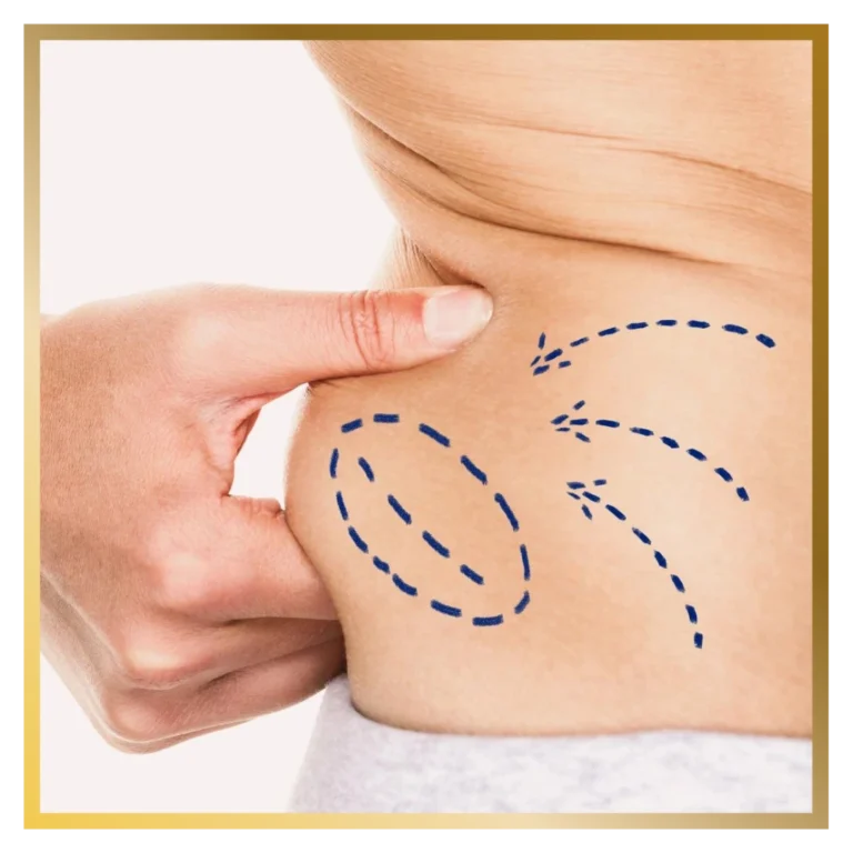 plastic-surgery-malaysia-reconstructive-surgeon-liposuction