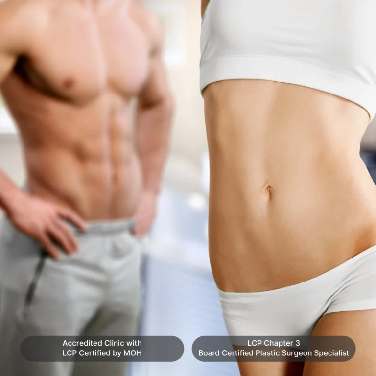 liposuction malaysia 14