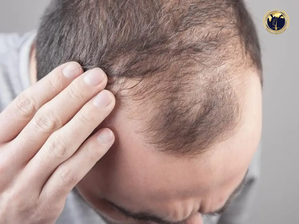 fue-hair-transplant-singapore-cost-cheaper