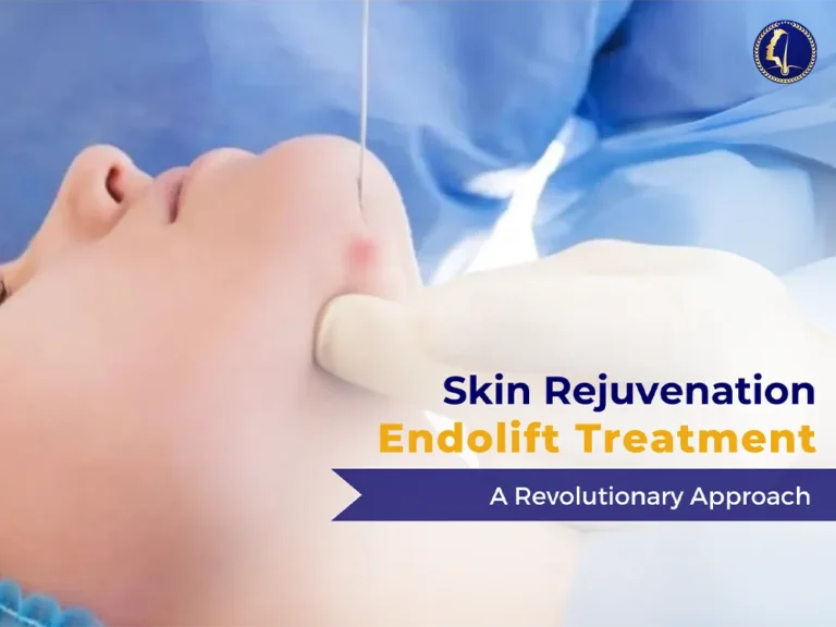 Endolift Treatment-skin-aesthetic-clinic