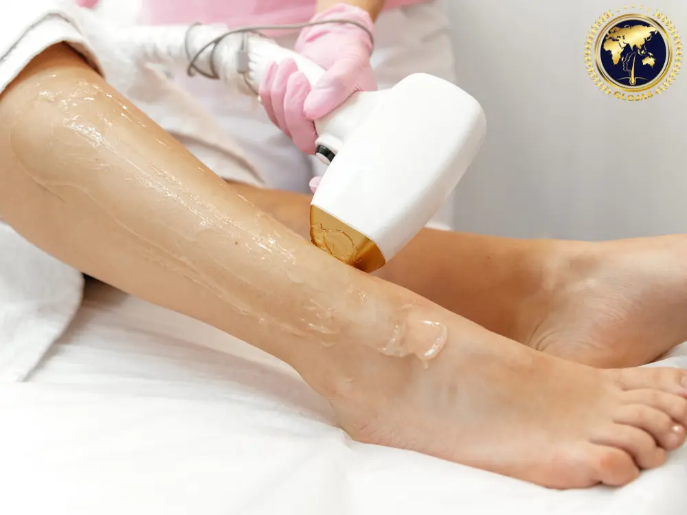 laser-for-hair-removal